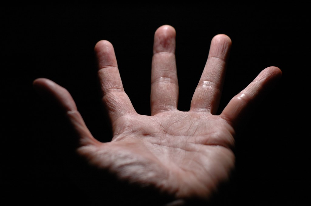 Fisioterapia post-tenolisi alle dita. Un programma specifico?