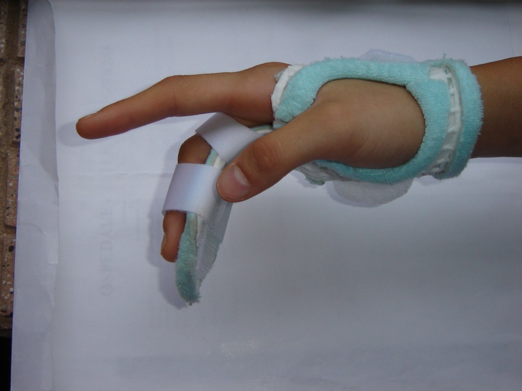 UN DITO CHE SCATTA.&nbsp;COS’E’?