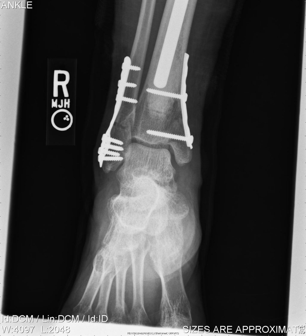 Perché la fisioterapia?