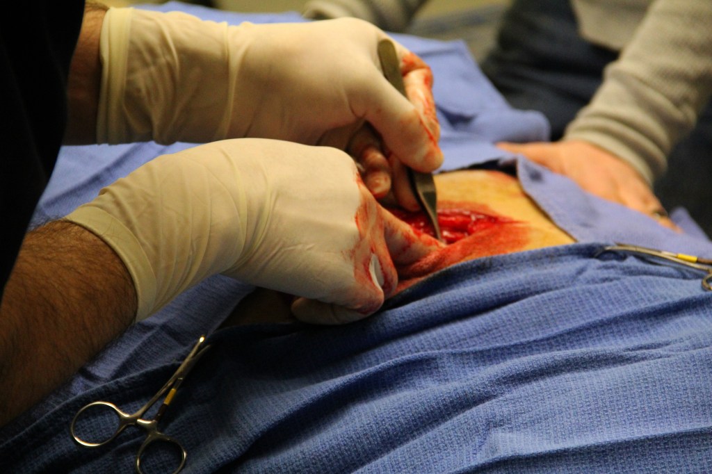 RECUPERO POST-OPERATORIO. TEMPI E MODI