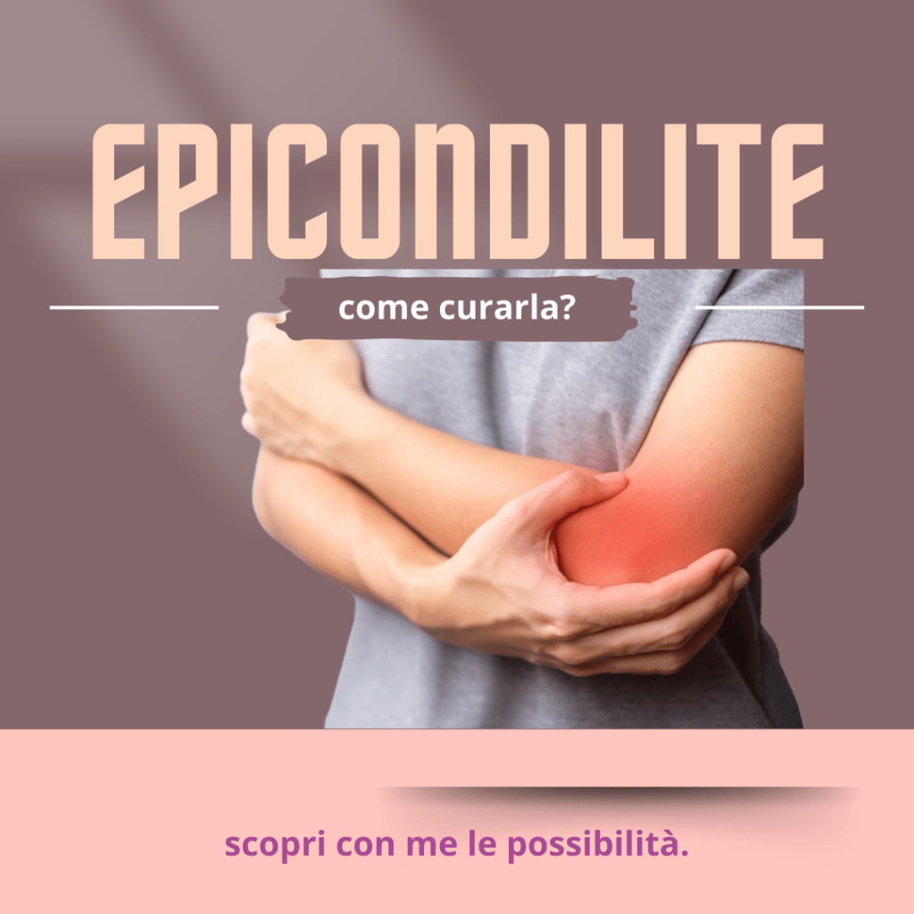 Trattamento Conservativo dell’Epicondilite: Strategie Efficaci per il Gomito del Tennista