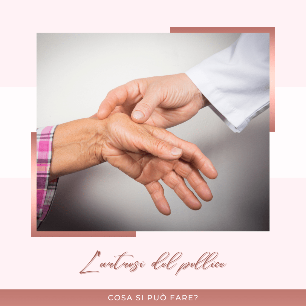 Combattere l’Artrosi del Pollice: Strategie Efficaci per Ridurre il Dolore e Migliorare la Mobilità.